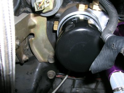 �I�C���t�B���^�u���b�N(�ォ�猩���Ƃ���)