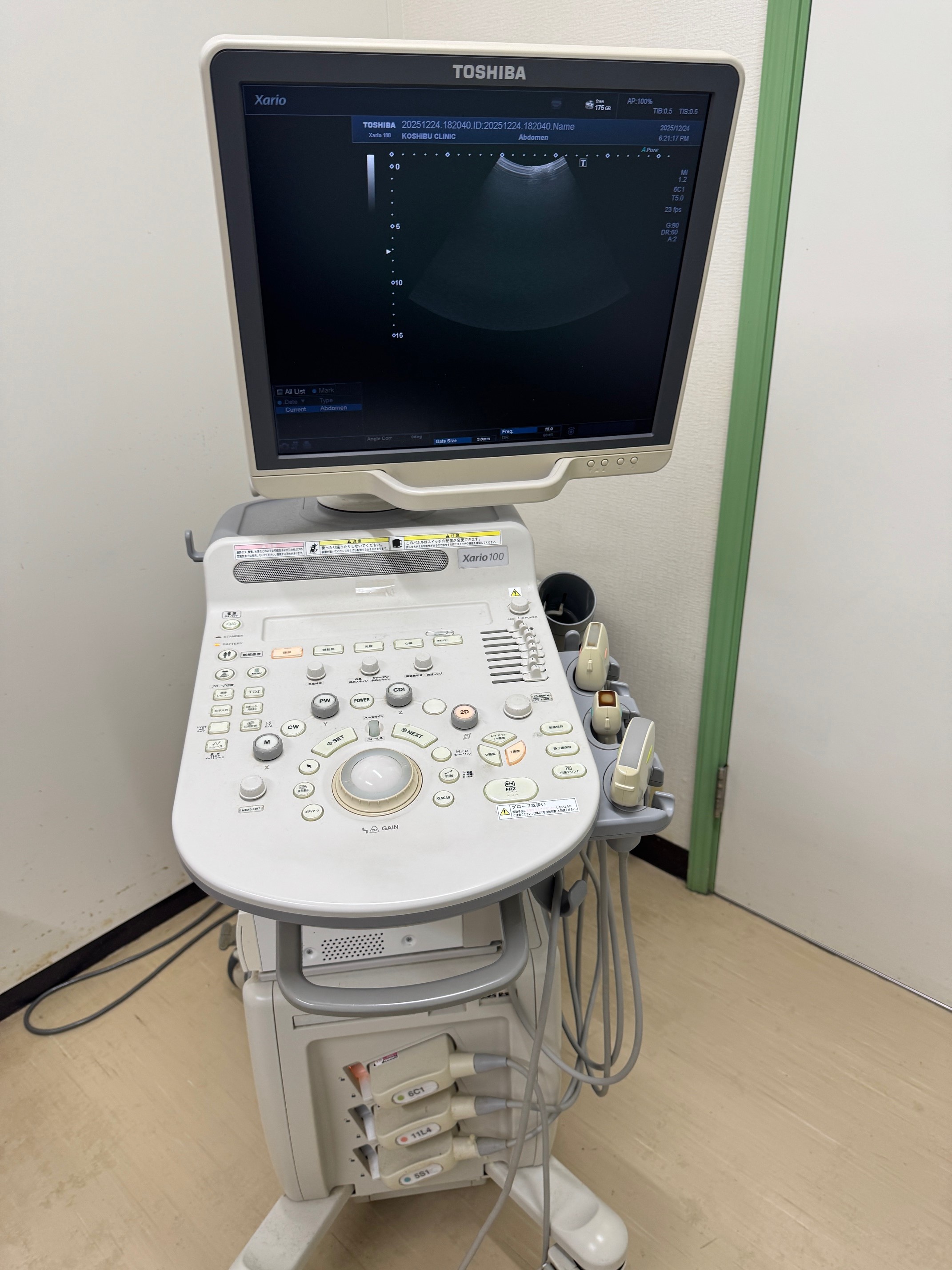 小渋医院（千葉市緑区）土気・あすみが丘・大網・誉田・市原エリアで行う腹部超音波検査