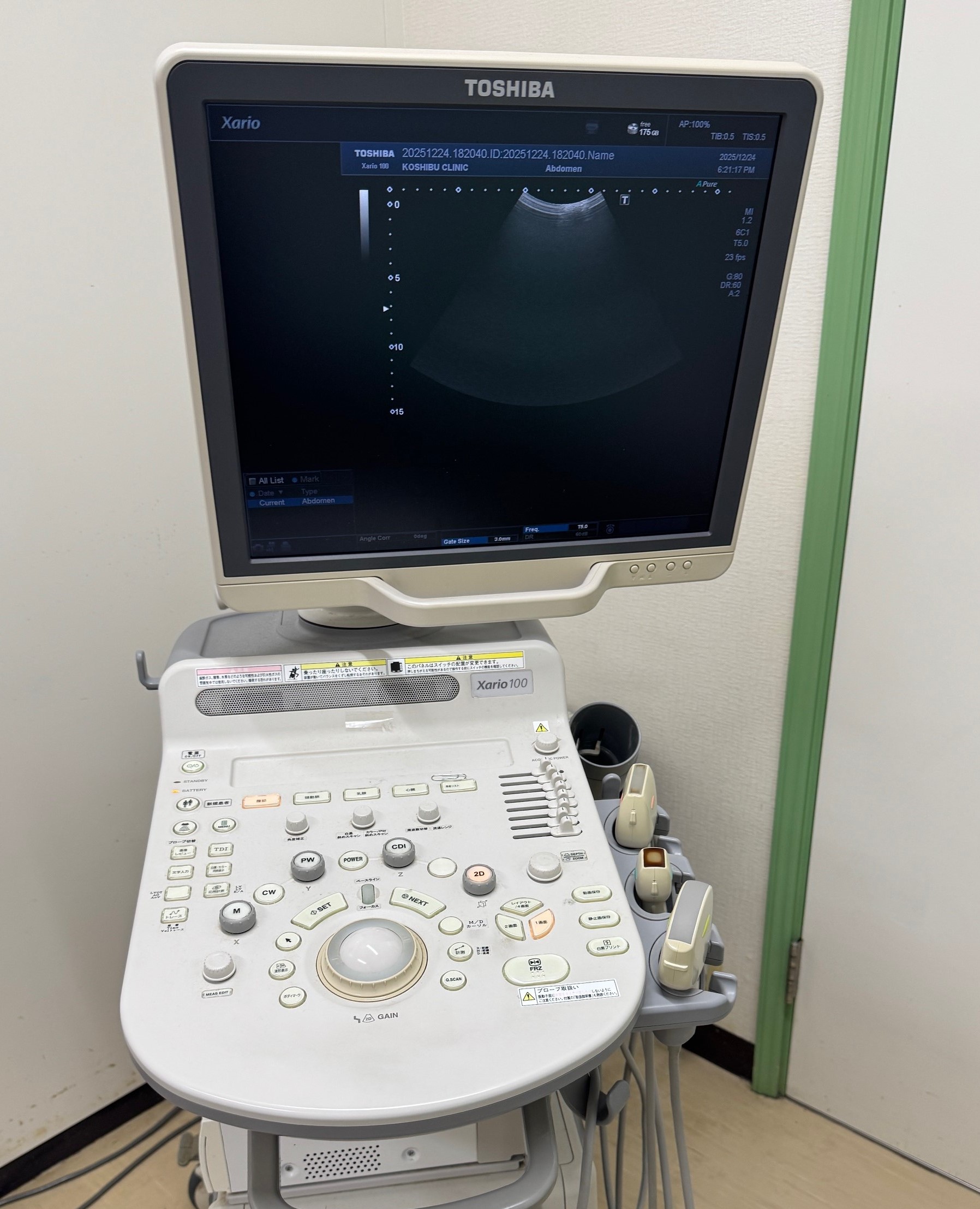 小渋医院（千葉市緑区）土気・あすみが丘・大網・誉田・市原エリアで行う心臓超音波検査