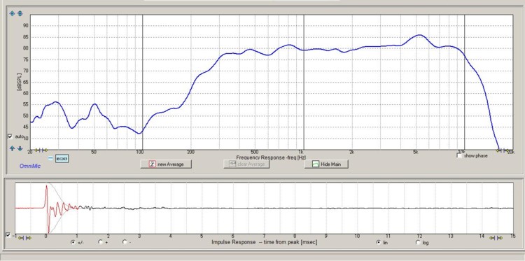 SB Acoustics MW16TX