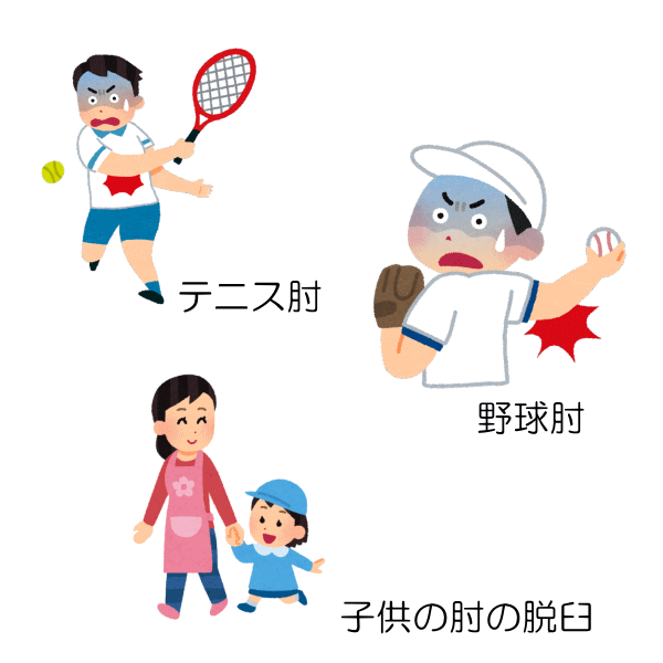 スポーツなどの肘の痛み　上尾中央はりきゅう接骨院
