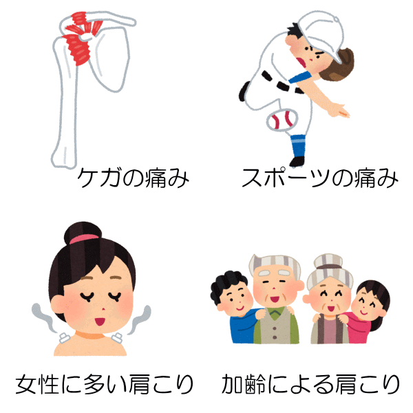スポーツなどの肩の痛み　上尾中央はりきゅう接骨院