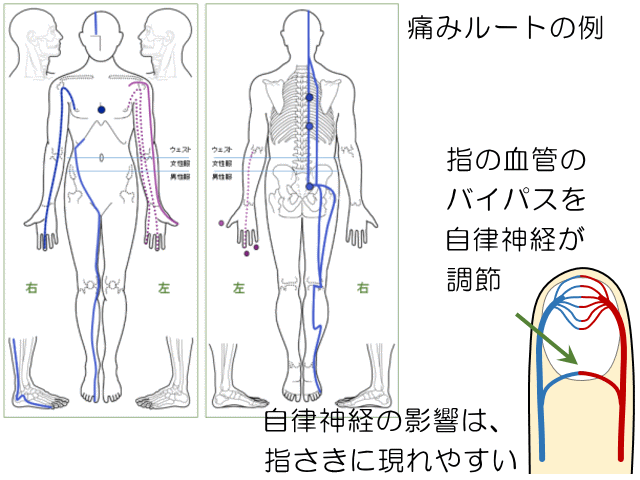 痛みルート