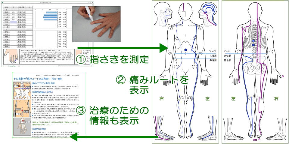 痛みルートの測定