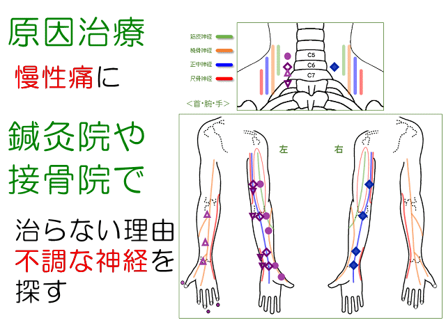 原因治療と不調な神経