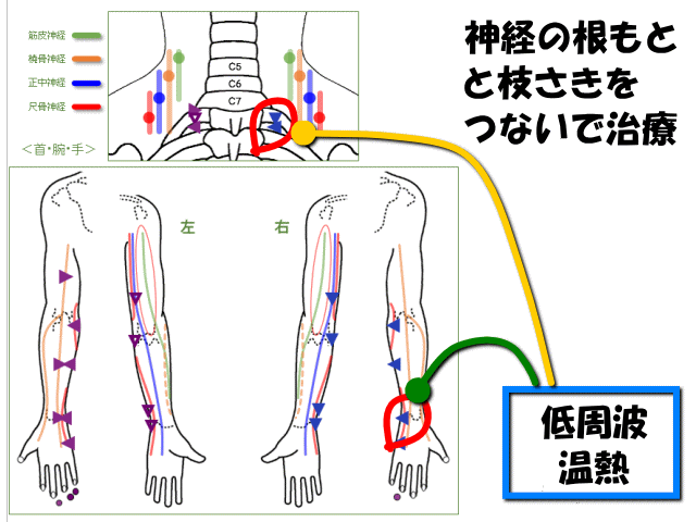 赤丸に治療　げんきＤＡＳ