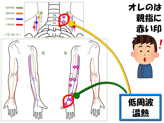 右肩の痛み　げんきＤＡＳ