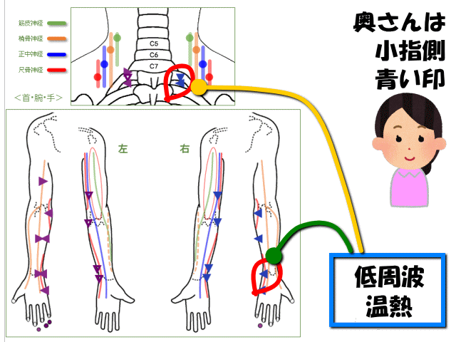 奥さんの肩こり　げんきＤＡＳ