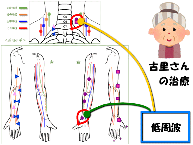 古里さんの治療内容　げんきＤＡＳ