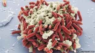 s_74550053_ecoli.jpg(57961 byte)
