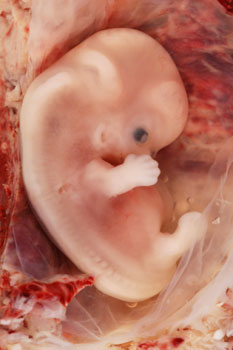 9-weekfetus.jpg(17725 byte)