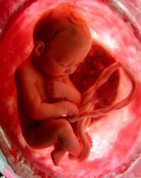 fetus.jpg(12895 byte)