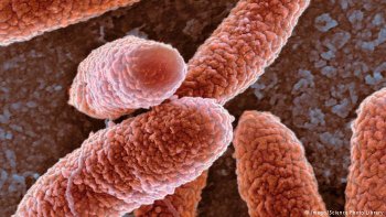 antiobiotic-resistant_germs.jpg(25872 byte)