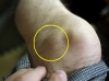 ganglion004.jpg