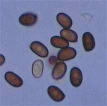 purpurellus-spore.jpg (3998 oCg)