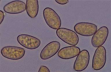 armillatus-spore.jpg (11285 oCg)