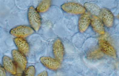 variecolor-spore.jpg (11736 oCg)