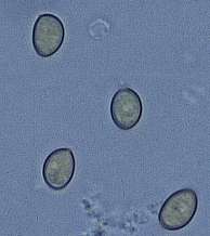 I-sp1-spore.jpg (4455 oCg)