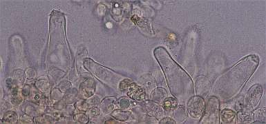 I-sp2-cystidia.jpg (10842 oCg)