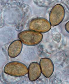 fuscidula-spore.jpg (10566 oCg)