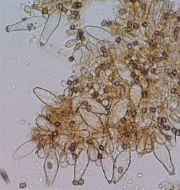 nodulosospora-cystidia.jpg (13990 oCg)