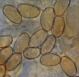 maculata-spore.jpg (10344 oCg)