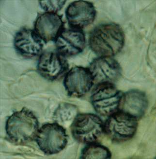 castanopsidis-spore.jpg (12051 oCg)
