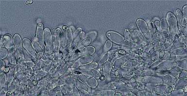 L-sp2-sterile.jpg (15974 oCg)