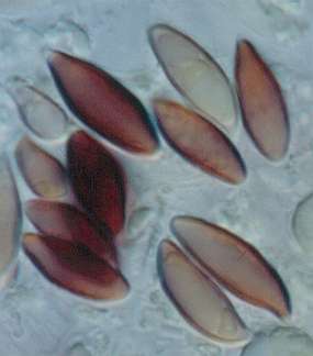 clypeolaria-spore.jpg (9314 oCg)