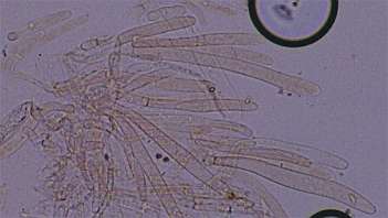 rubrotinctus-pileipellis.jpg (9007 oCg)