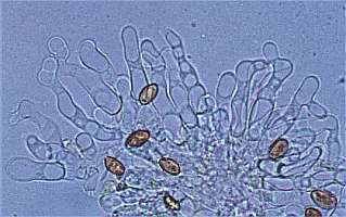 pholiota-sp1-cheilo.jpg (14115 oCg)