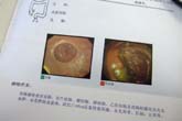 内視鏡健診：クリックで拡大