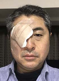 眼帯写真