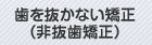 歯を抜かない矯正（非抜歯矯正）