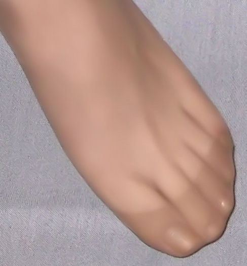 toe