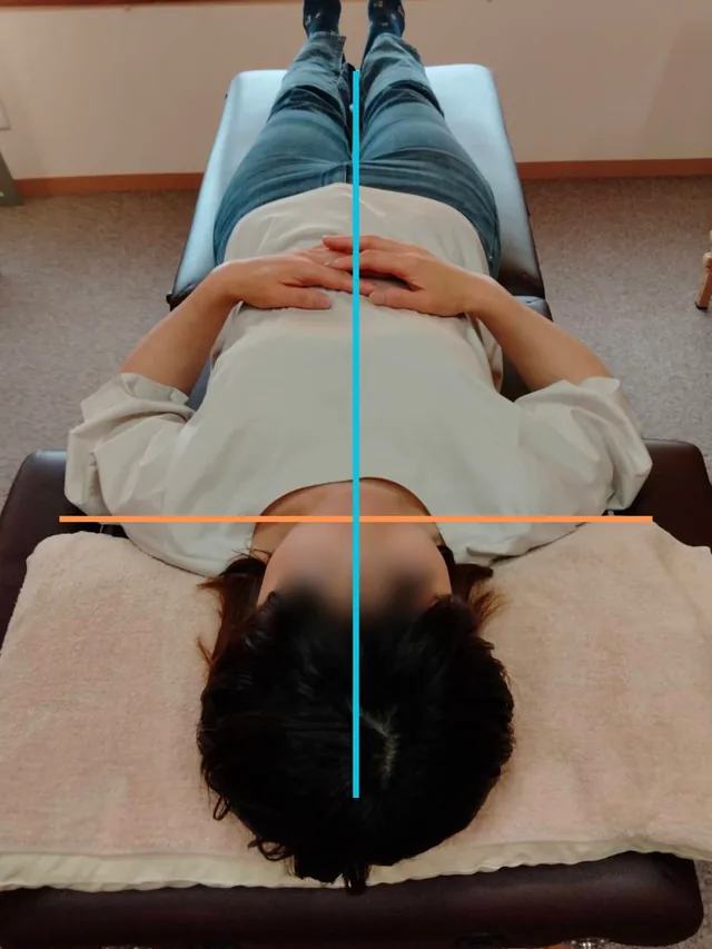 施術後の姿勢確認写真。中心線と肩まわりの目安線を入れています。
