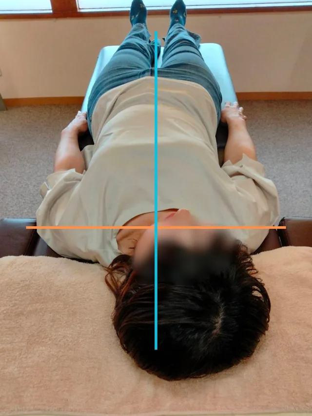 施術前の姿勢確認写真。中心線と肩まわりの目安線を入れています。