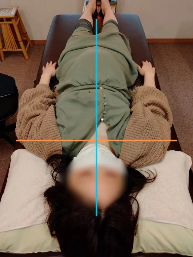 施術後の姿勢確認写真。中心線と肩まわりの目安線を入れています。