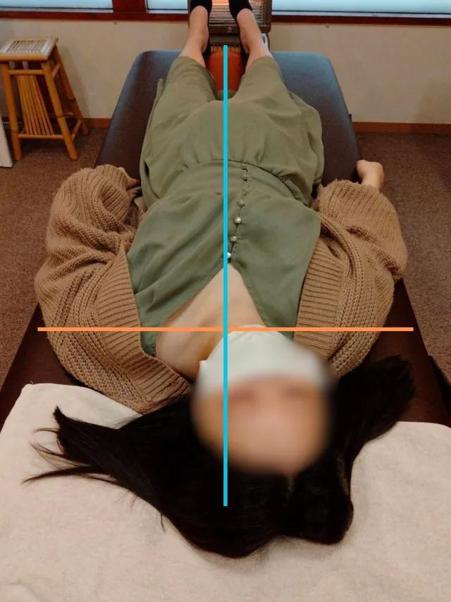 施術前の姿勢確認写真。中心線と肩まわりの目安線を入れています。
