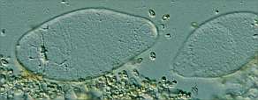 C-sp2-pleuro.jpg (6742 oCg)