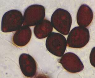 plicatilis-spore.jpg (8003 oCg)