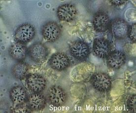 lactarius-sp1-spore.jpg (17987 oCg)