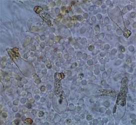 pho-sp3-pleuro.jpg (11488 oCg)